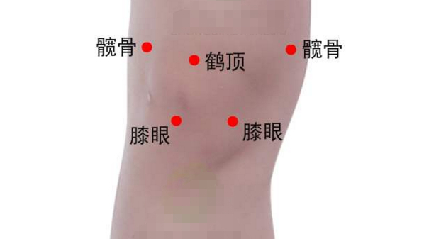 鹤顶穴:通利关节,祛风除湿,活络止痛!